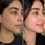 سرم هیالورونیک ‌اسید تراست - تصویر 3
