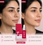 سرم روشن کننده تراست