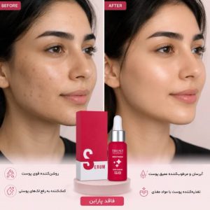 سرم روشن کننده تراست