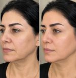 کرم سفت‌کننده صورت و گردن - تصویر 3