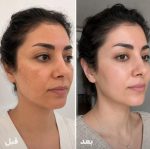 کرم روشن کننده و ضد لک - تصویر 3