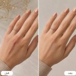 کرم ترمیم کننده پوست تراست - تصویر 3