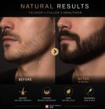 روغن تقویت ریش آقایان تراست - تصویر 2